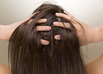 Does Dandruff Cause Hair Fall