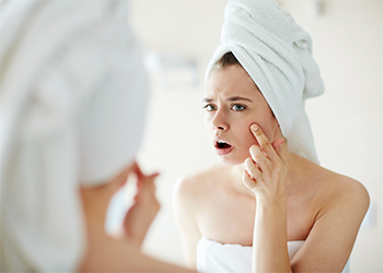 Coconut-Oil-and-Acne-350Wx250H-03 Coconut oil and Acne