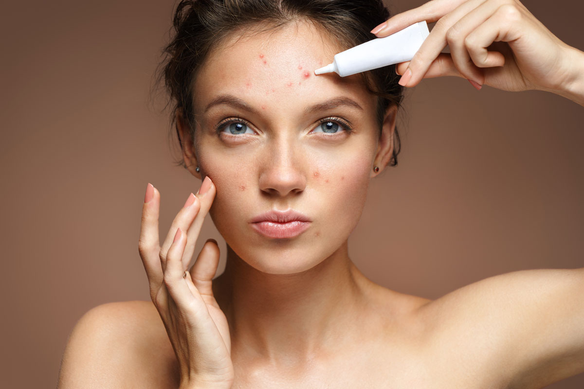 Acne Spot Treatment