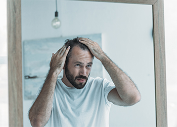 Signs of Balding in Men